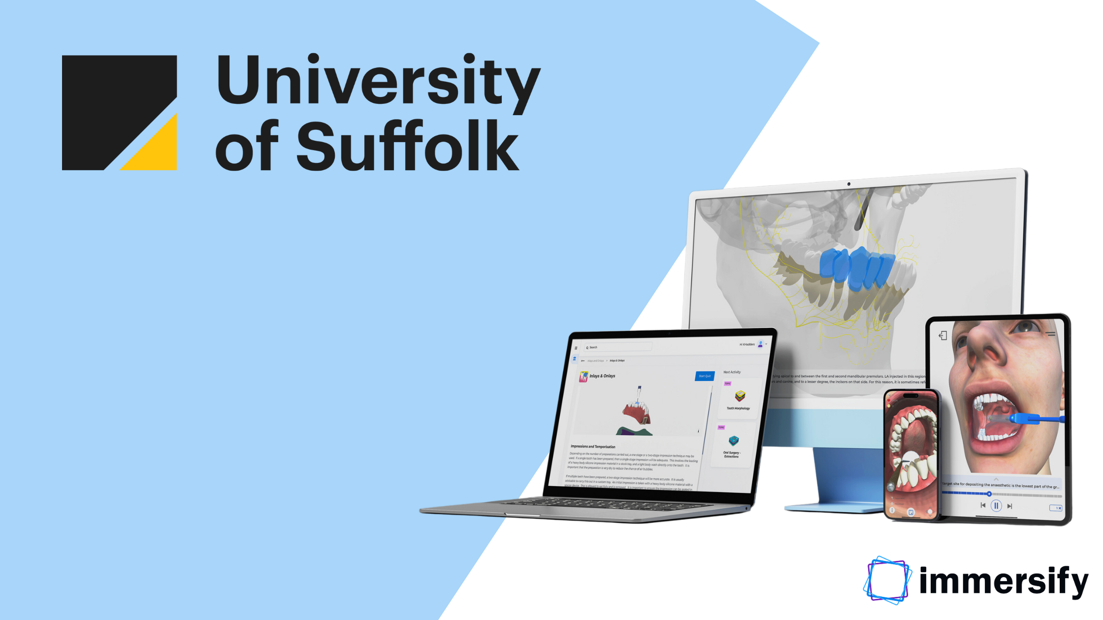 University of Suffolk and Immersify University of Suffolk and Immersify